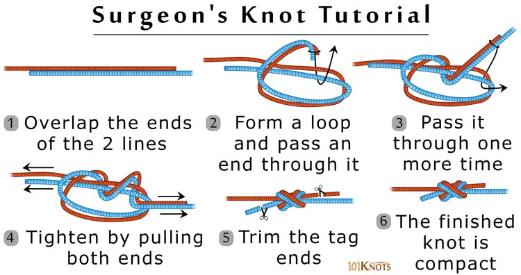 how to tie a surgeon's knot